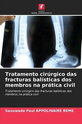 Tratamento cirúrgico das fracturas balísticas dos membros na prática civil