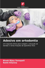 Title: Adesivo em ortodontia, Author: Bivek Bijoy Senapati