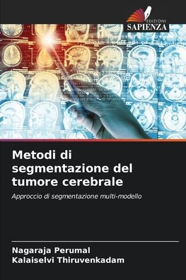 Metodi di segmentazione del tumore cerebrale