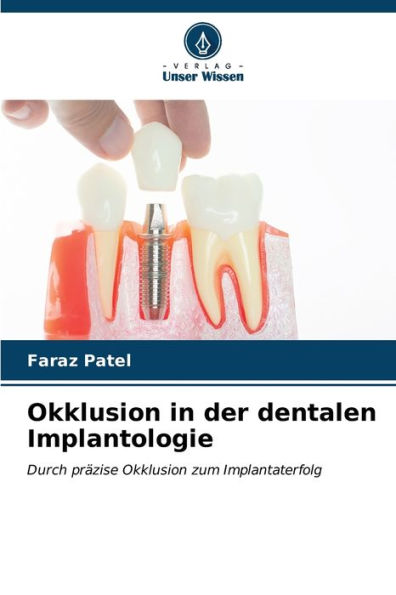 Okklusion in der dentalen Implantologie