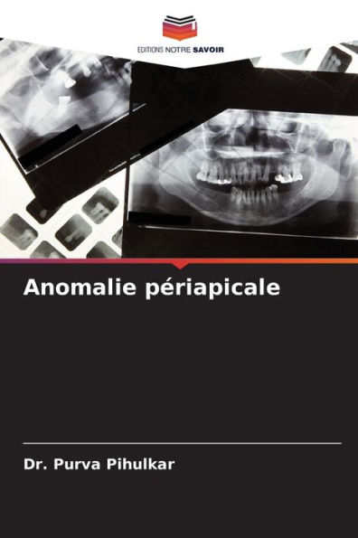 Anomalie périapicale