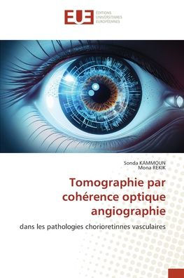 Tomographie par cohï¿½rence optique angiographie