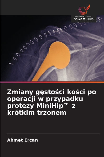 Zmiany gęstości kości po operacji w przypadku protezy MiniHip(TM) z krÃ¯Â¿Â½tkim trzonem