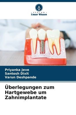Ã¯Â¿Â½berlegungen zum Hartgewebe um Zahnimplantate
