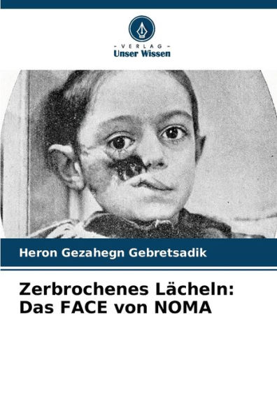 Zerbrochenes LÃ¤cheln: Das FACE von NOMA