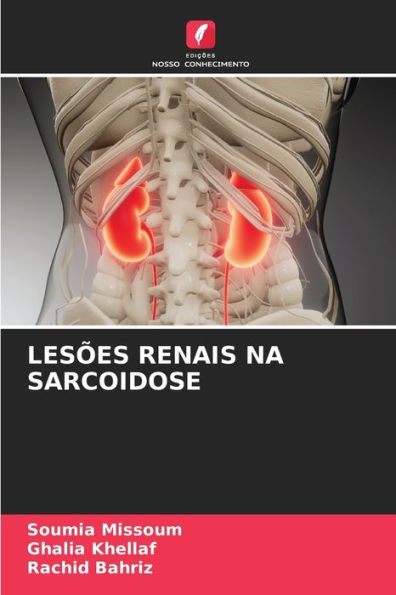 LesÃ¯Â¿Â½es Renais Na Sarcoidose