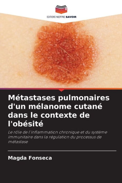 MÃ©tastases pulmonaires d'un mÃ©lanome cutanÃ© dans le contexte de l'obÃ©sitÃ©