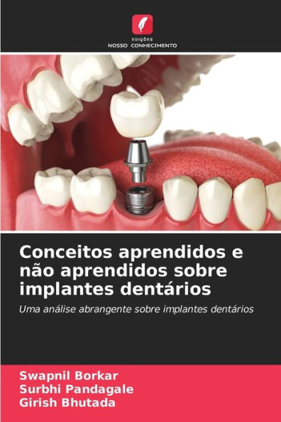 Conceitos aprendidos e nÃ£o aprendidos sobre implantes dentÃ¡rios