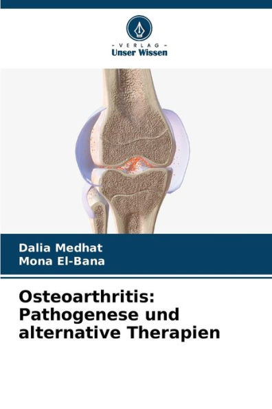 Osteoarthritis: Pathogenese und alternative Therapien