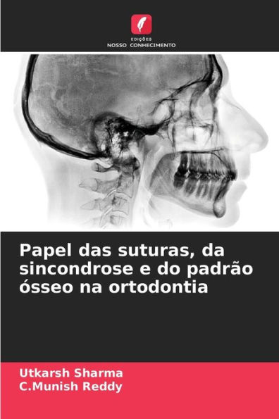 Papel das suturas, da sincondrose e do padrÃ£o Ã³sseo na ortodontia