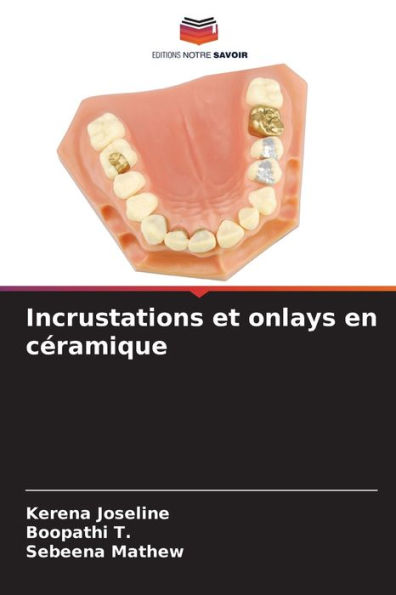 Incrustations et onlays en cÃ©ramique