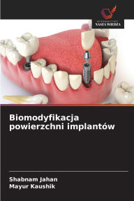 Title: Biomodyfikacja powierzchni implantï¿½w, Author: Shabnam Jahan