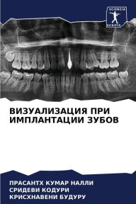 Title: ВИЗУАЛИЗАЦИЯ ПРИ ИМПЛАНТАЦИИ ЗУБОВ, Author: ПРАСАНТ& НАЛЛИ