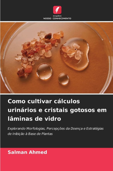 Como cultivar cï¿½lculos urinï¿½rios e cristais gotosos em lï¿½minas de vidro