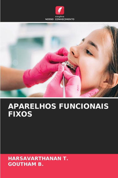 Aparelhos Funcionais Fixos