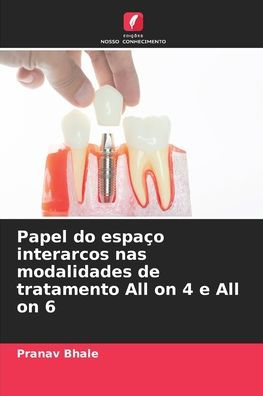 Papel do espaï¿½o interarcos nas modalidades de tratamento All on 4 e All on 6