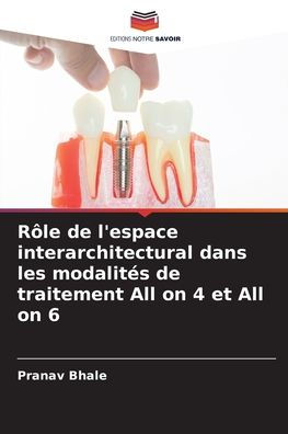 Rï¿½le de l'espace interarchitectural dans les modalitï¿½s de traitement All on 4 et All on 6