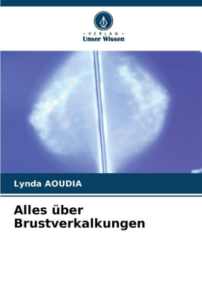 Alles ï¿½ber Brustverkalkungen