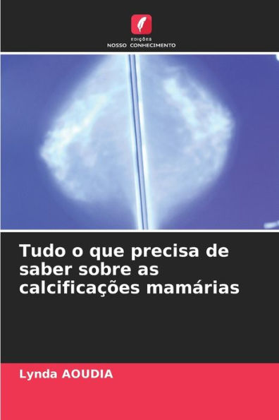Tudo o que precisa de saber sobre as calcificaï¿½ï¿½es mamï¿½rias