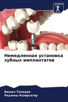 Немедленная установка зубных имплантато
