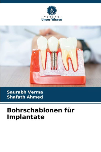 Bohrschablonen fï¿½r Implantate