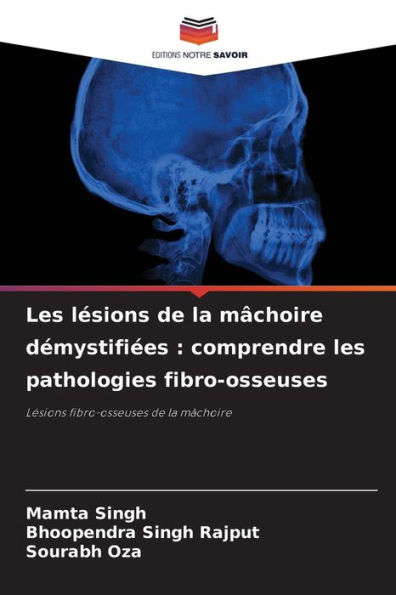 Les lï¿½sions de la mï¿½choire dï¿½mystifiï¿½es: comprendre les pathologies fibro-osseuses
