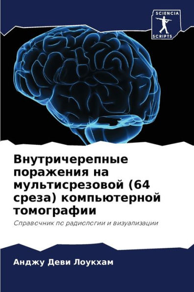 Внутричерепные поражения на мультисрезо
