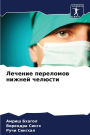 Лечение переломов нижней челюсти