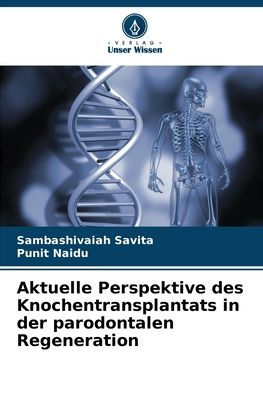Aktuelle Perspektive des Knochentransplantats in der parodontalen Regeneration