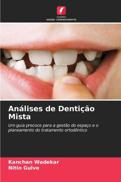 Anï¿½lises de Dentiï¿½ï¿½o Mista