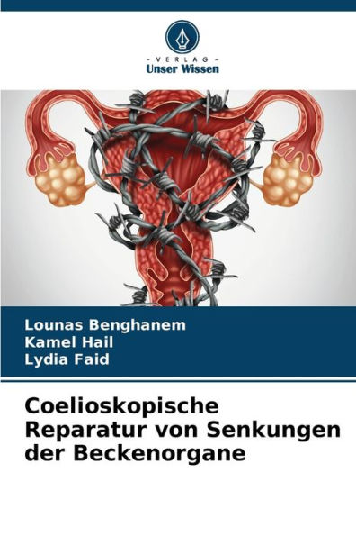 Coelioskopische Reparatur von Senkungen der Beckenorgane