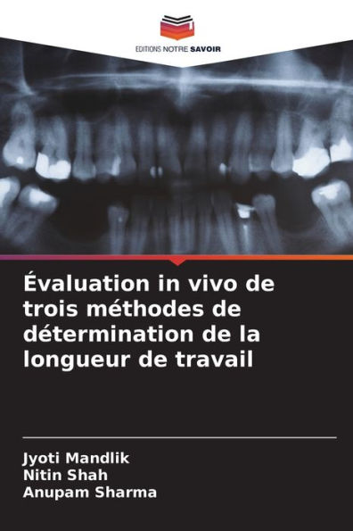 ï¿½valuation in vivo de trois mï¿½thodes de dï¿½termination de la longueur de travail