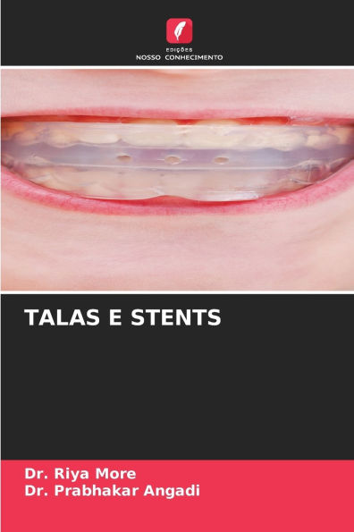 Talas E Stents