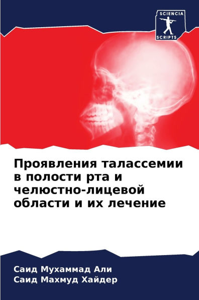 Проявления талассемии в полости рта и чел
