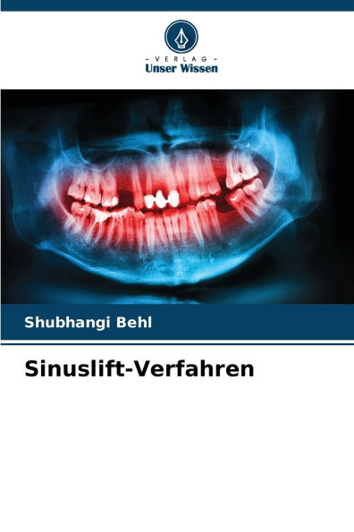 Sinuslift-Verfahren