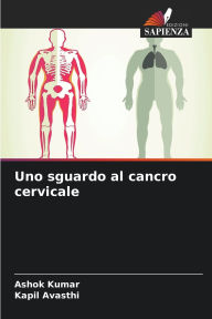 Title: Uno sguardo al cancro cervicale, Author: Ashok Kumar