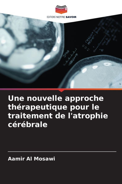 Une nouvelle approche thï¿½rapeutique pour le traitement de l'atrophie cï¿½rï¿½brale