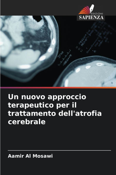 Un nuovo approccio terapeutico per il trattamento dell'atrofia cerebrale