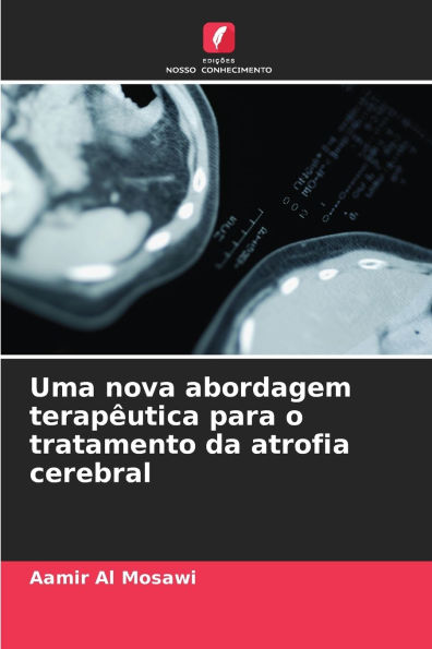Uma nova abordagem terapï¿½utica para o tratamento da atrofia cerebral