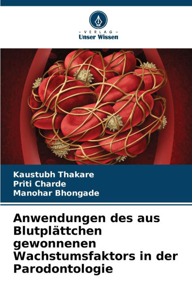 Anwendungen des aus Blutplï¿½ttchen gewonnenen Wachstumsfaktors in der Parodontologie