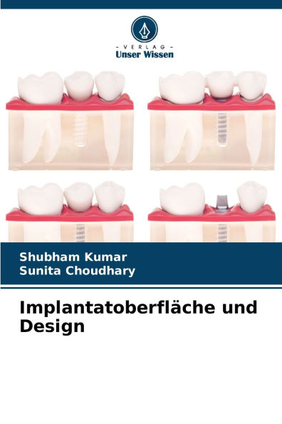 Implantatoberflï¿½che und Design