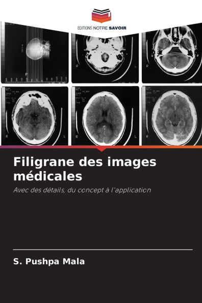 Filigrane des images mï¿½dicales