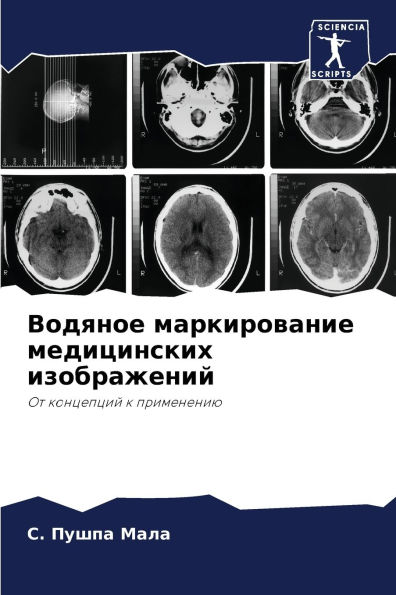 Водяное маркирование медицинских изобра