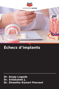 Title: ï¿½checs d'implants, Author: Anuja Lugade