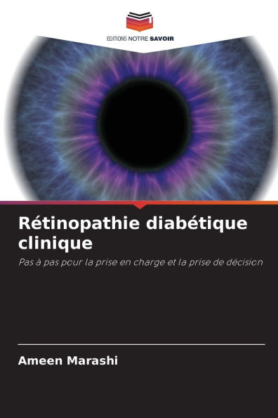Rï¿½tinopathie diabï¿½tique clinique