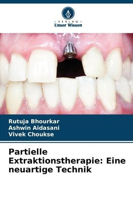 Partielle Extraktionstherapie: Eine neuartige Technik