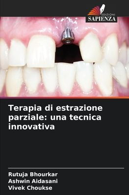 Terapia di estrazione parziale: una tecnica innovativa