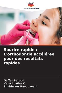 Sourire rapide: L'orthodontie accï¿½lï¿½rï¿½e pour des rï¿½sultats rapides