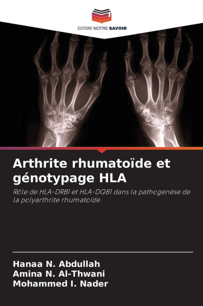 Arthrite rhumatoï¿½de et gï¿½notypage HLA