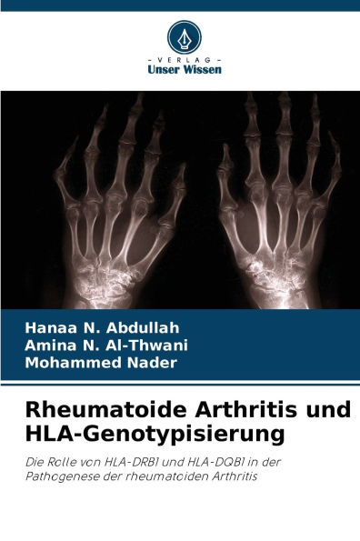 Rheumatoide Arthritis und HLA-Genotypisierung